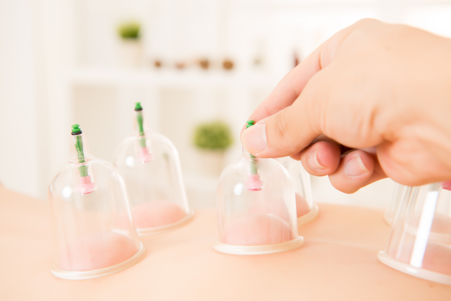 Cupping Therapy Spa 